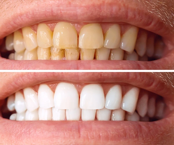 dental1
