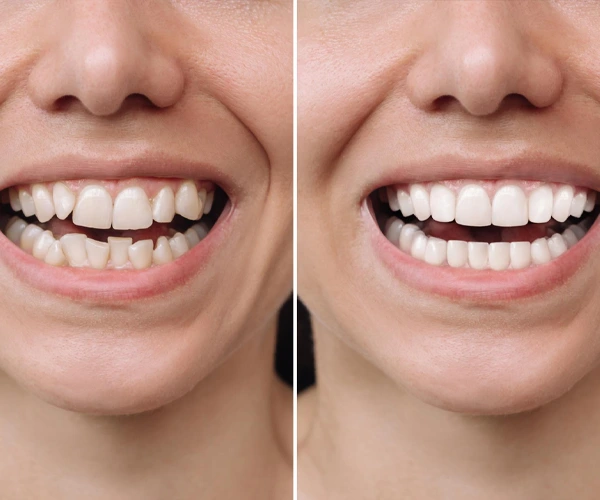 dental2